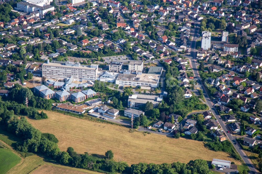 Erbach from the bird's eye view: Hospital grounds of the Clinic Kreiskrankenhaus Erbach on street Albert-Schweitzer-Strasse in Erbach Odenwaldkreis in the state Hesse, Germany